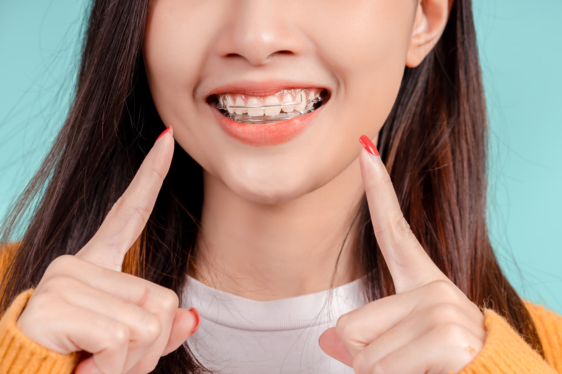 Girl with an orthodontic retainer in Apex, NC