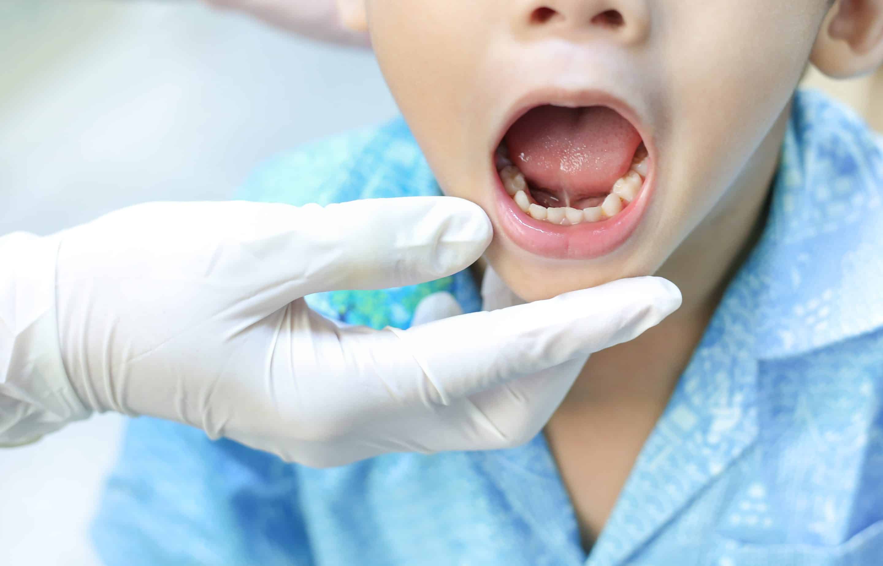 Dental cancer exam in Apex, NC