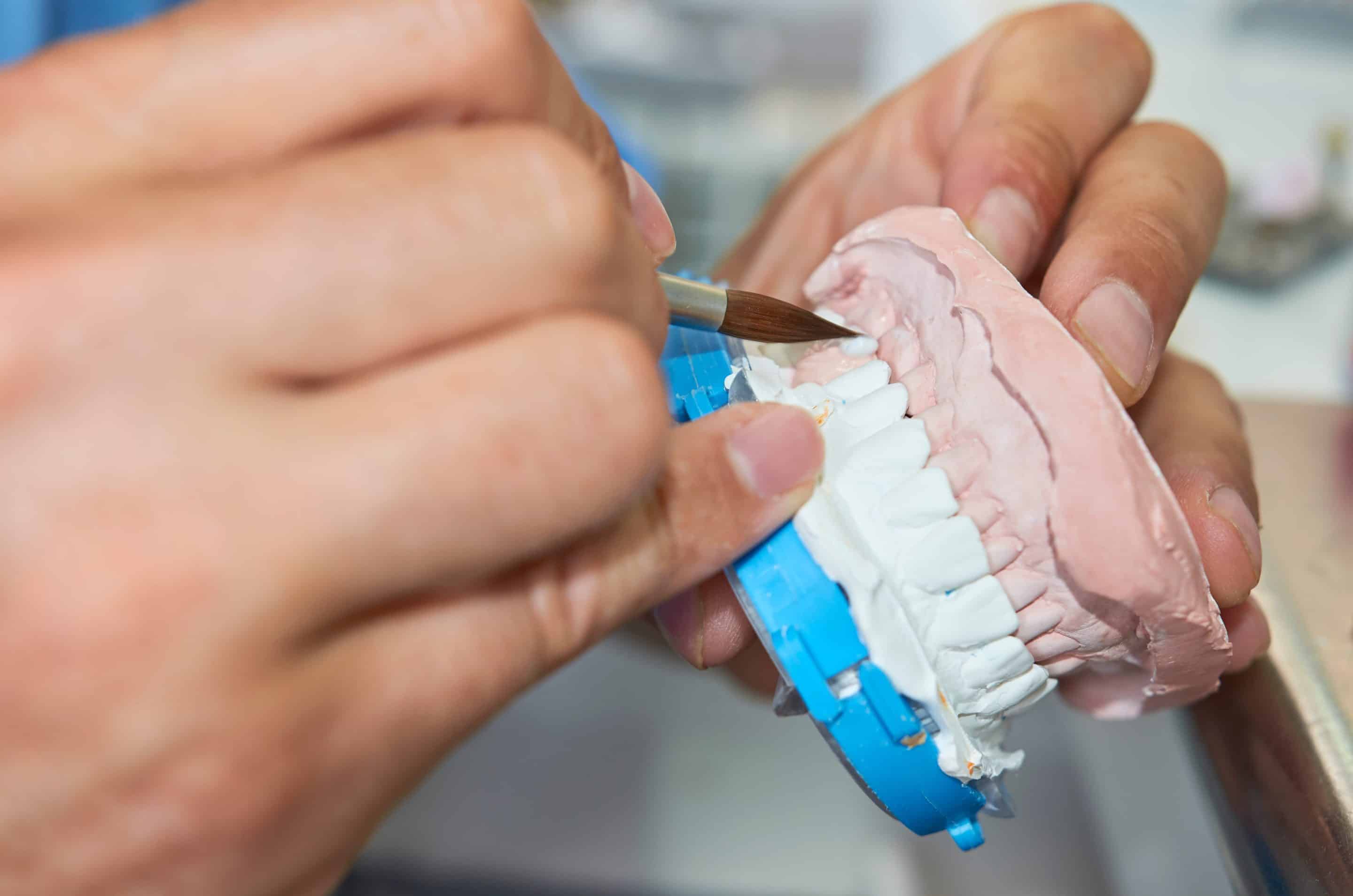 Inlay and onlay dentist in Apex, NC