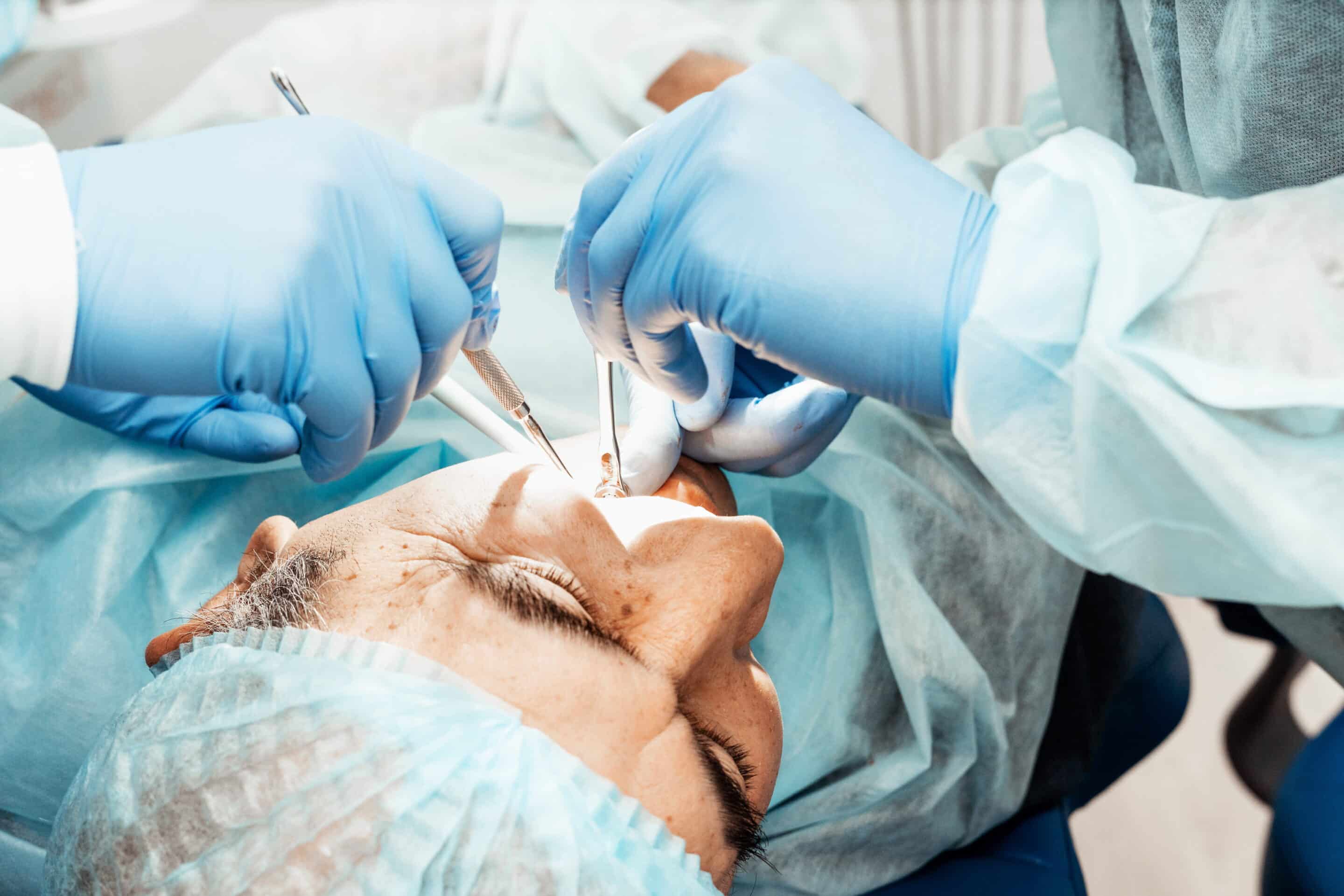 Surgical tooth extractions in Apex, NC